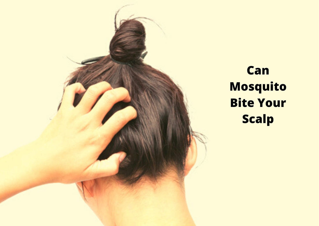 Can Mosquito Bite Your Scalp