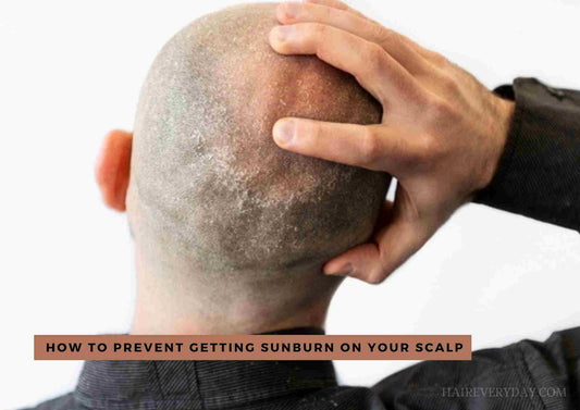 Sunburn On The Scalp